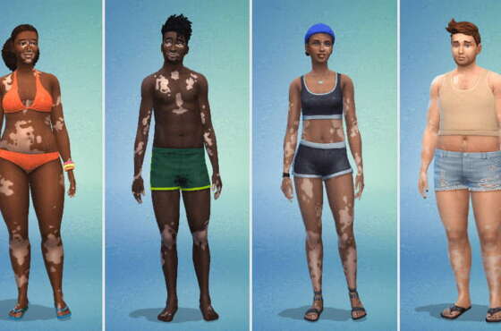 Los Sims 4 introduce la función de piel de vitíligo