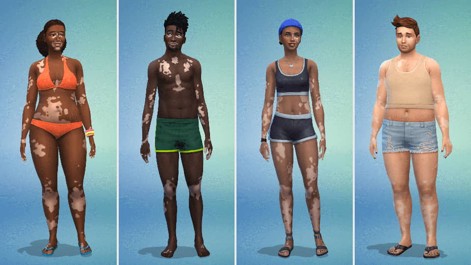 Los Sims 4 introduce la función de piel de vitíligo